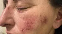 Teacher beaten by student reveals injuries for first time
