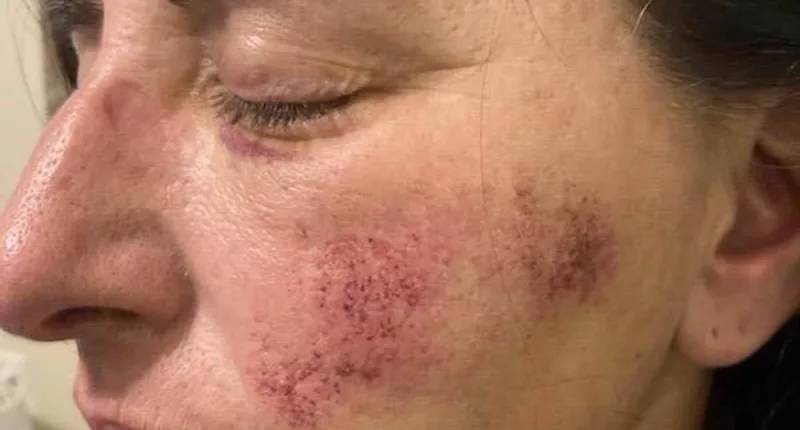 Teacher beaten by student reveals injuries for first time