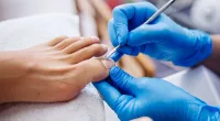 Toenail fungus laser treatment: Everything you need to know