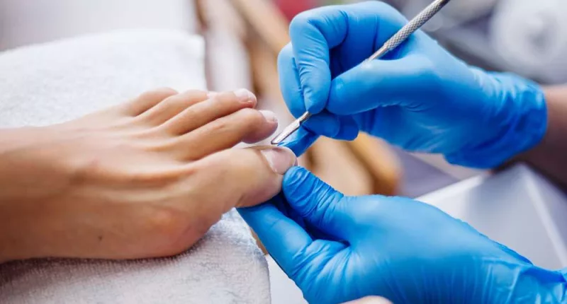 Toenail fungus laser treatment: Everything you need to know
