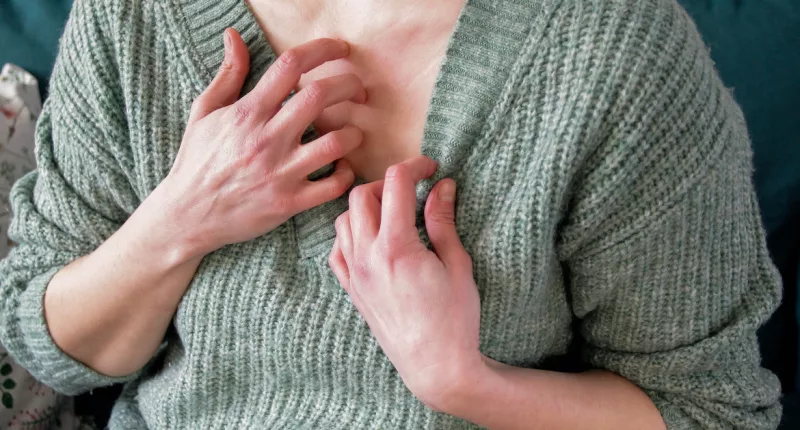 Um, Why Are My Nipples So Itchy Right Now? What To Know About Nipple Eczema