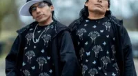 Are Lil Mike And Funny Bone Dwarfs | Medical Condition