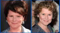 Did Imelda Staunton Undergo Plastic Surgery? Husband And Kids