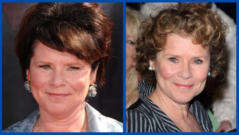 Did Imelda Staunton Undergo Plastic Surgery? Husband And Kids