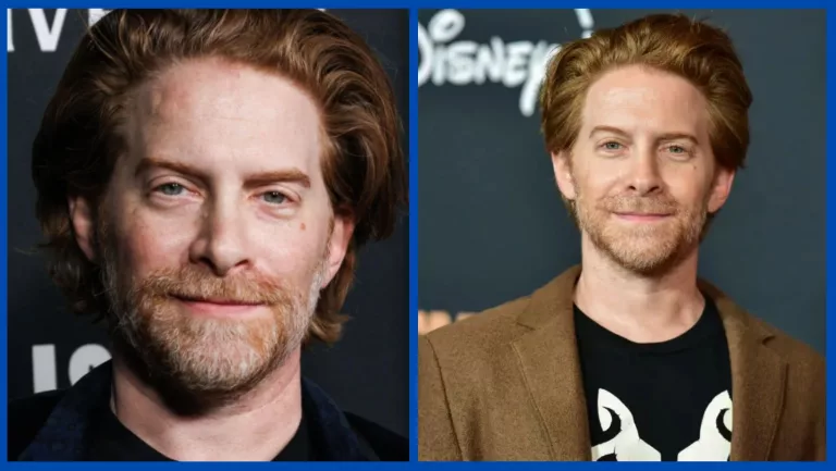 Did Seth Green Undergo Plastic Surgery On His Nose? Net Worth, Wife And Kids
