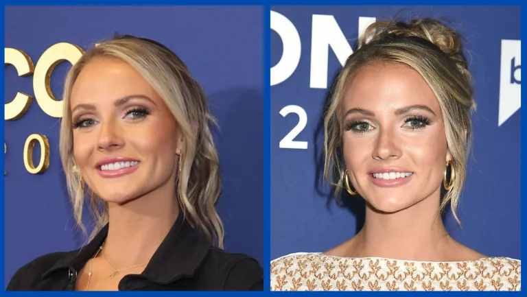 Did Taylor Ann Green Undergo Plastic Surgery? Net Worth Explored