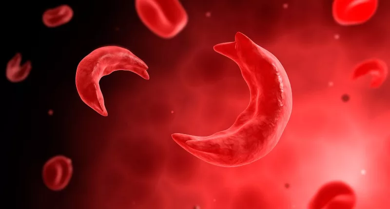 FDA approves gene-editing drug for treatment of sickle-cell disease