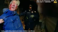 Briem’s face was slammed into the driveway while he was getting handcuffed which caused his face to start bleeding