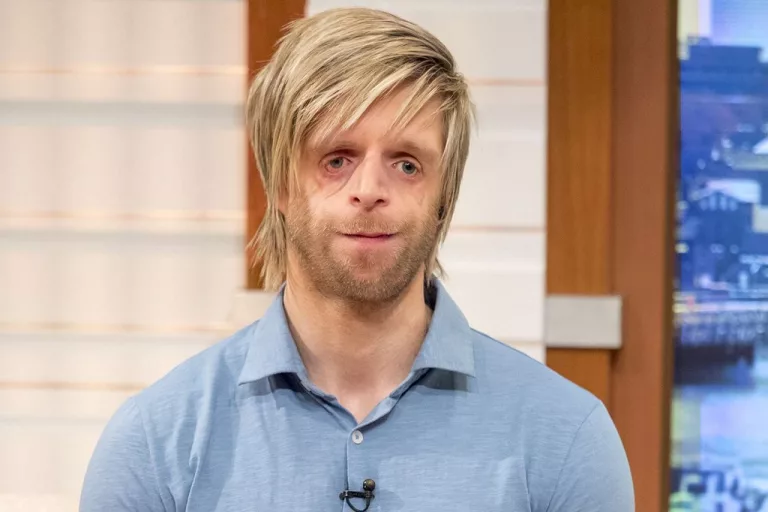 Jono Lancaster Wikipedia And Age: What Is Wrong With Face?