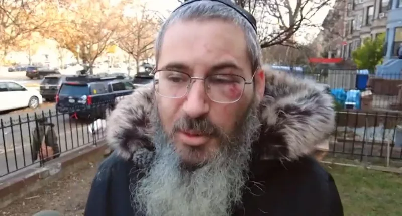 NYC Jewish man punched, robbed outside his home on first day of Hanukkah: ‘I want this person caught’
