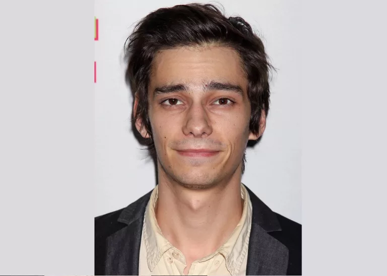 What Happened To Devon Bostick Face? Before Plastic Surgery