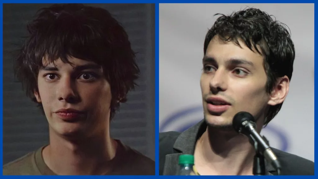 What Is Wrong With Actor Devon Bostick Face? Illness Update