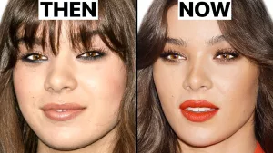 Hailee Steinfeld Nose Job And Plastic Surgery Details