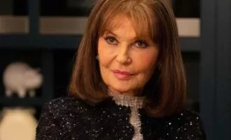 Has Stephanie Beacham had Plastic Surgery? Who is Stephanie Beacham ?