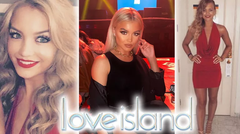 Love Island: Molly Smith Nose Job And Plastic Surgery