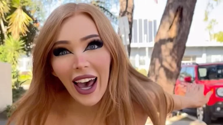 Stormigee No Makeup 2024: Before After Plastic Surgery