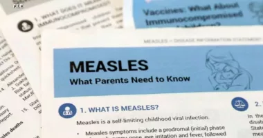 Measles outbreak 2024: Case reported in Lake County, Indiana; measles vaccine clinics to open next week