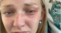 A photo of killed blogger Gabby released by her family’s lawyer revealed cuts, bruises, and smeared blood on her face