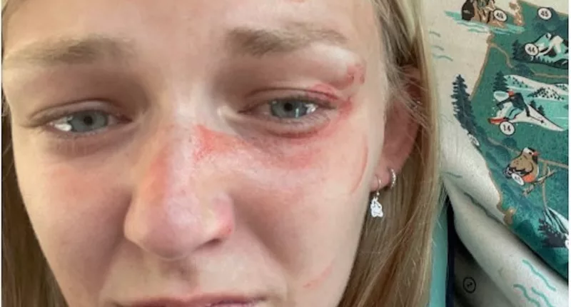 A photo of killed blogger Gabby released by her family’s lawyer revealed cuts, bruises, and smeared blood on her face