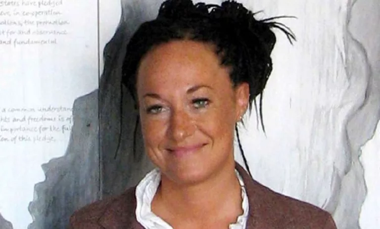 Rachel Dolezal Before And Now: Did She Undergo Surgery?