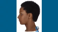 Skeletal remains ID'd as Portland teen missing more than 50 years