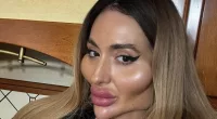 Ukrainian with 'the world's biggest cheeks' reveals what fans ask her