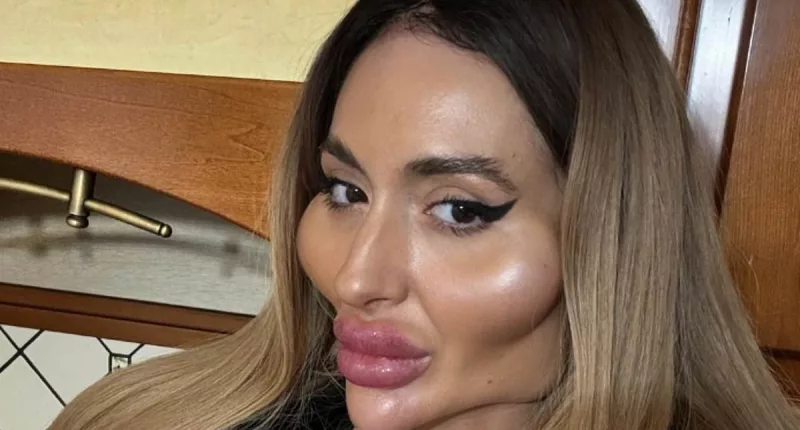 Ukrainian with 'the world's biggest cheeks' reveals what fans ask her