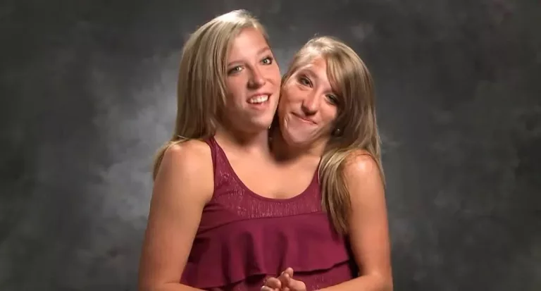 Abby and Brittany Hensel’s Family Shares a Strong Connection