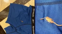 Man set to sue Vegas hotel after he was stung by scorpion