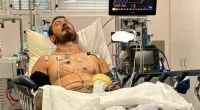 Snake catcher fighting for life after ﻿horror bite
