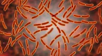 What causes lack of Lactobacillus?