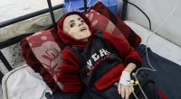 Yazan Al Kafarneh Before And After