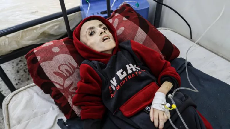 Yazan Al Kafarneh: His Transformation from Life to Death Due to Malnutrition