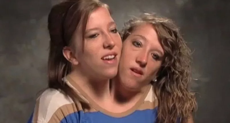 Conjoined twin Abby Hensel of ‘Abby & Brittany’ fame is married