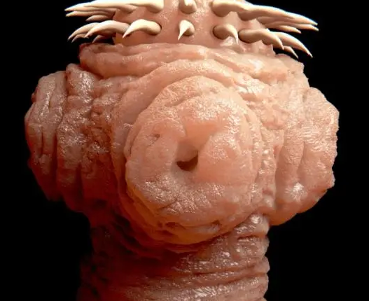 What Is Neurocysticercosis? Its Causes, Symptoms And Treatment