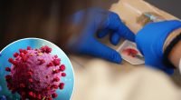Shocking new study links COVID-19 to cancer regression