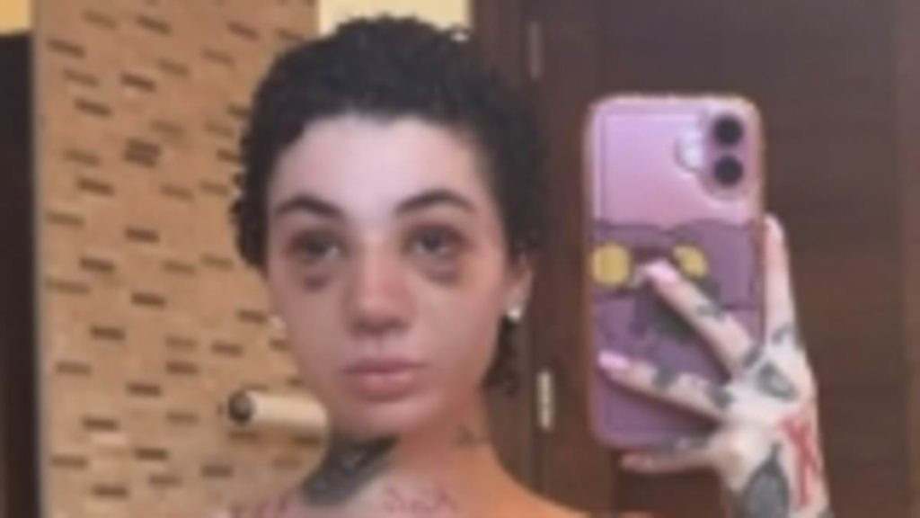 Bhad Bhabie reveals she had a nose job amid her battle with cancer