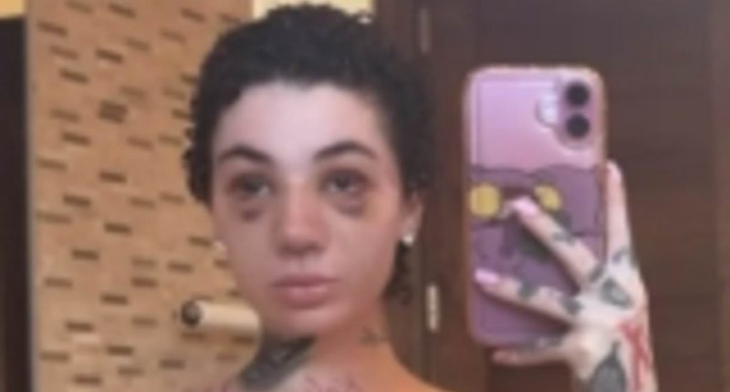 Bhad Bhabie reveals she had a nose job amid her battle with cancer