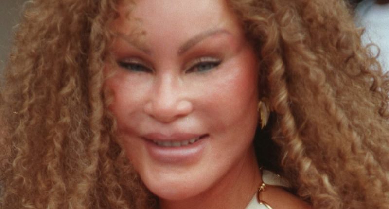 'Catwoman' Jocelyn Wildenstein dead at 84