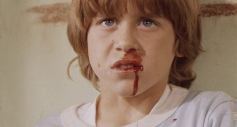 Young Christian Juttner with a bloody nose on the set of ABC Afterschool Specials.