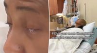 North Carolina mother, Ria Faggart, mistakes nail glue for eyedrops, glues eyes shut