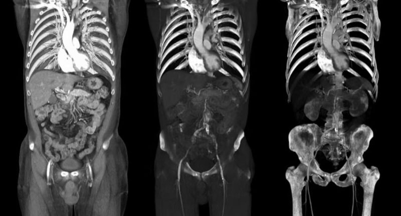 Scientists say they've found cause of so many unexplained cancers