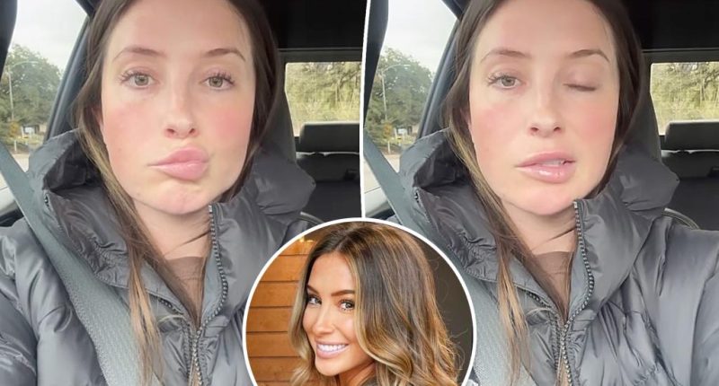 ‘Worried’ Bristol Palin reveals facial paralysis from neurological disorder ‘brought on by stress’