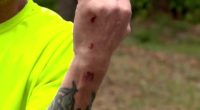 Coyote attacks man, service dog during walk in Florida neighborhood: report