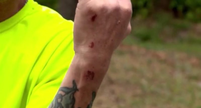 Coyote attacks man, service dog during walk in Florida neighborhood: report