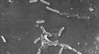 Move over H5N1: The next pandemic is already here 