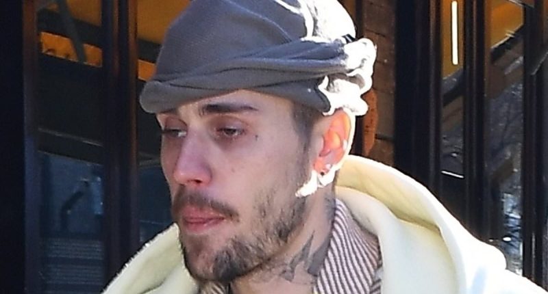 The changing face of Justin Bieber as concerns over appearance grow