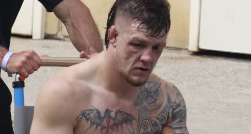 Brutal aftermath of a UFC fight you don't see on TV: Bloodied and broken fighters are wheeled out of Sydney arena surrounded by beauties - as Dana White goes nuclear on Aussie journo for digging up ghosts from his past