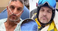 Mauricio Umansky hospitalized with broken clavicle after skiing accident in Aspen