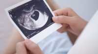 Missouri bill proposes registry for pregnant mothers to 'reduce preventable abortions'